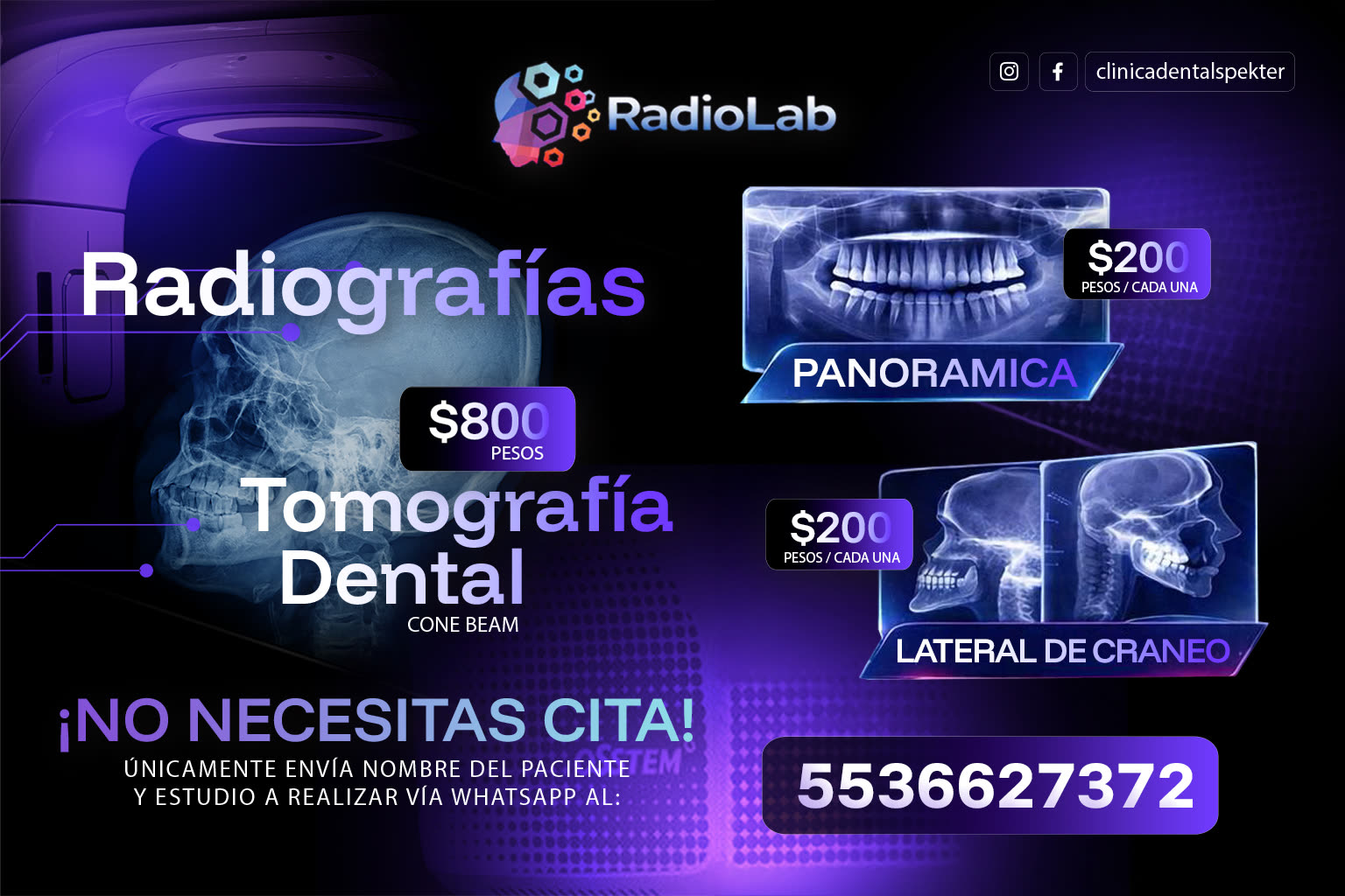 Radio Lab: radiografía panorámica y lateral de cráneo, $200 pesos cada una; tomografía dental Cone Beam, $800 pesos. No necesitas cita: envía el nombre del paciente y el estudio a realizar por WhatsApp al 55 3662 7372.